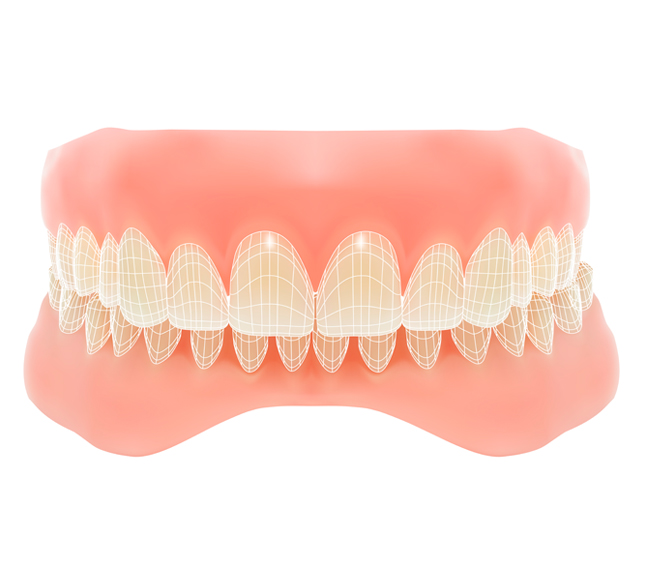 hinboca clinica dental es especialista en casos complejos de implantes dentales