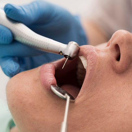 endodoncia-hinboca-1